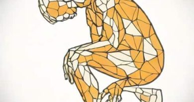 Facet Joint Arthritis Prognosis